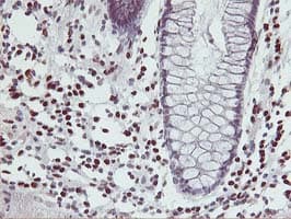 MEF2C Antibody (clone OTI2B12, Carrier-free)