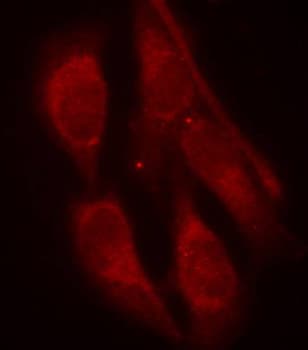 p66 / SHC Antibody (phospho-Tyr427)