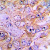 Polyclonal Rabbit anti-Human CASP3 / Caspase 3 Antibody (Internal, IHC, IF, WB)