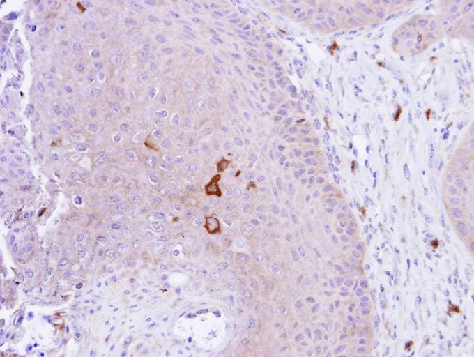 PADI4 / PAD4 Antibody (aa326-611)