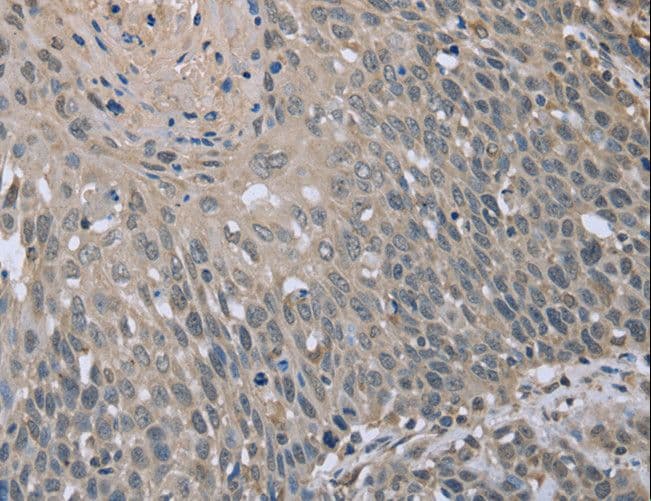 Polyclonal Rabbit anti-Human ETK / BMX Antibody (IHC)