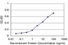 IHC-plus™ Monoclonal Mouse anti-Human UBTF / UBF Antibody (clone 2D8, IHC, IF, WB)