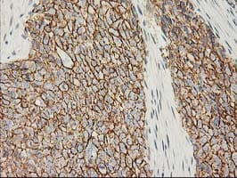 CTNNB1 / Beta Catenin Antibody (clone OTI1B11)