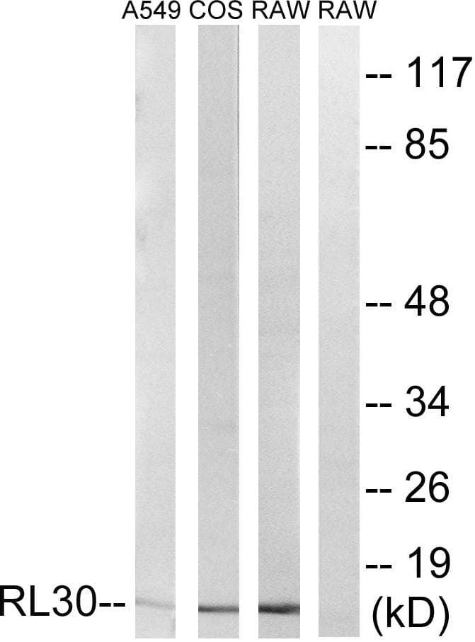 Polyclonal Rabbit anti-Human RPL30 / Ribosomal Protein L30 Antibody (IHC, WB)