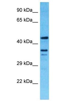 TMEM116 Antibody (aa229-278)