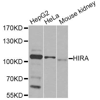 HIRA Antibody