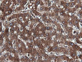 PIK3C2B Antibody (clone OTI3B1)