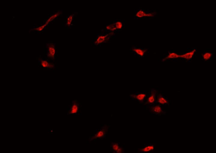 Polyclonal Rabbit anti-Human DNMT3B Antibody (IHC, IF, WB)