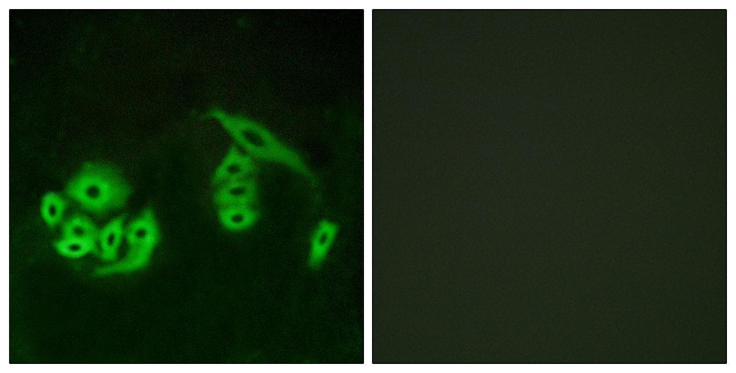 GPR12 Antibody