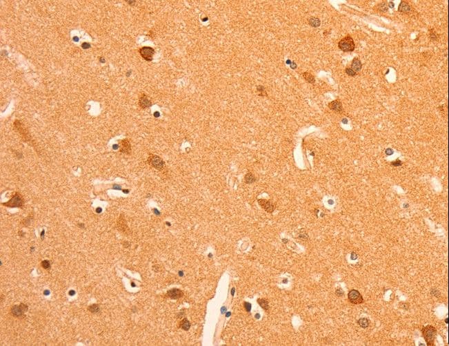GRM3 / MGLUR3 Antibody
