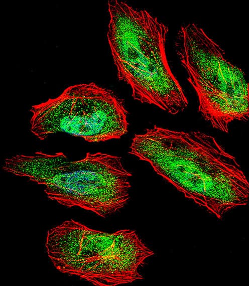 Polyclonal Rabbit anti-Human TSN / Translin Antibody (aa109-138, IHC, IF, WB)