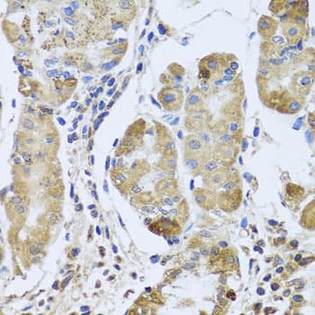 Polyclonal Rabbit anti-Human EFHC1 Antibody (IHC, WB)