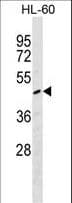 Polyclonal Rabbit anti-Human F2R / Thrombin Receptor / PAR1 Antibody (aa35-63, WB)