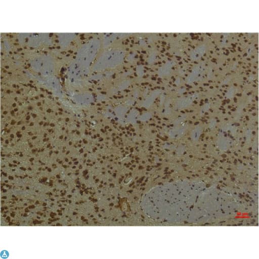 PIK3R1 / p85 Alpha Antibody