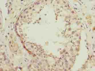 NSUN7 Antibody