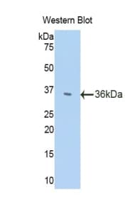 HPSE / Heparanase Antibody (aa280-412)