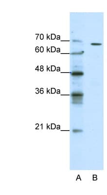 GABRQ / THETA Antibody (aa31-80)