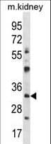 TFIIB Antibody (aa42-71)
