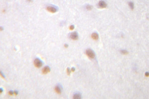 Polyclonal Rabbit anti-Human CTNND1 / p120 Catenin Antibody (Gly224, IHC, WB)