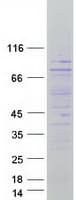 Human CTDSPL2 Protein (Recombinant Myc-DDK (Flag))
