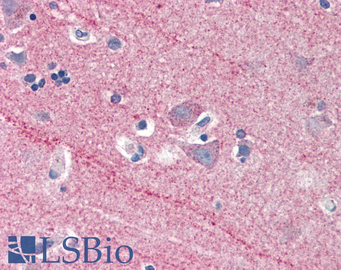 IHC-plus™ ICAM5 / ICAM-5 Antibody (aa909-920)