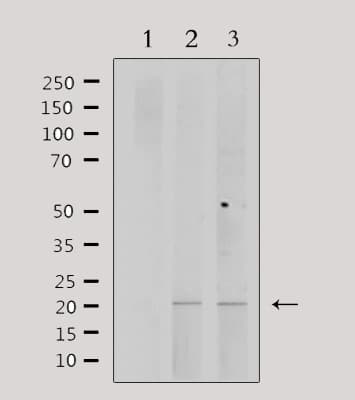 PPP1R14C / KEPI Antibody