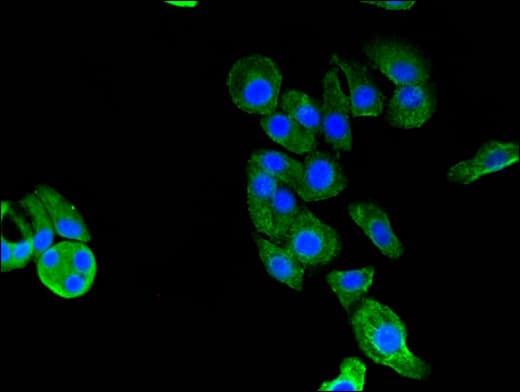Polyclonal Rabbit anti-Human GARS / Glycyl tRNA Synthetase Antibody (IHC, IF, WB)