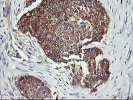 DNM1L / DRP1 Antibody (clone OTI4F6)