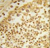 RPL31 / Ribosomal Protein L31 Antibody (aa24-51)