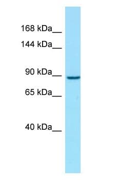 VIL1 / Villin Antibody (C-Terminus, FITC)