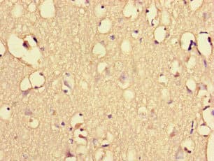 Polyclonal Rabbit anti-Human EHD3 Antibody (IHC, IF)