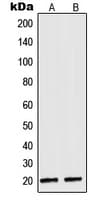NDUFA8 Antibody (Internal)