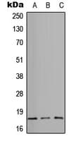 ITGA5/Integrin Alpha 5/CD49e Antibody (Internal)