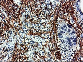 Monoclonal Mouse anti-Human TAGLN / Transgelin / SM22 Antibody (clone 8C8, Carrier-free, IHC, IF, WB)