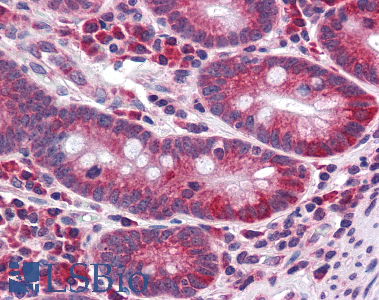 IHC-plus™ CDHR5 / MUCDHL Antibody (Cytoplasmic Domain)