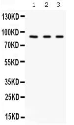 CFB / Complement Factor B Antibody