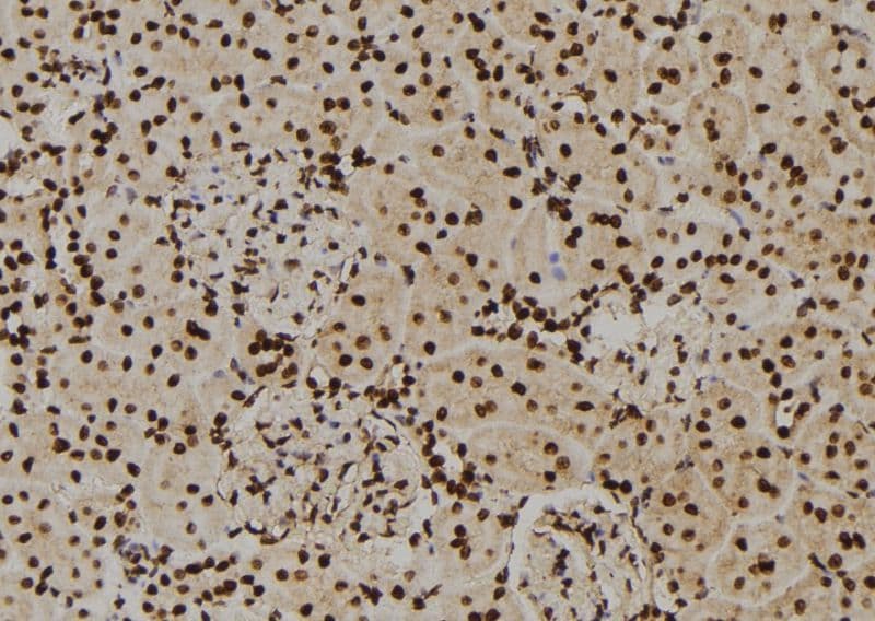 HNRNPA2B1 Antibody