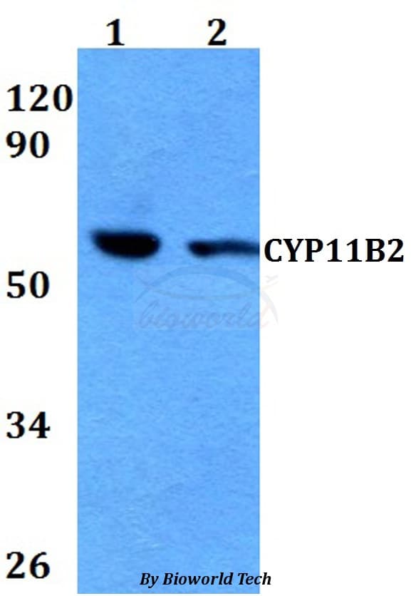 CYP11B2 / Aldosterone Synthase Antibody
