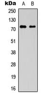SLC44A1 / CD92 Antibody (Internal)
