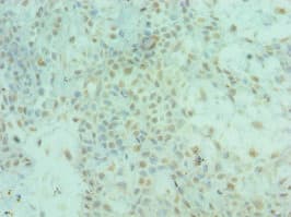 ALS2 / Alsin Antibody (aa1-280)