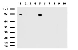 NBN / Nibrin Antibody (aa461-754, clone UMAB99)