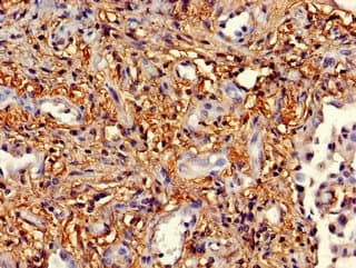 Polyclonal Rabbit anti-Human MAPK14 / p38 Antibody (IHC, IF)