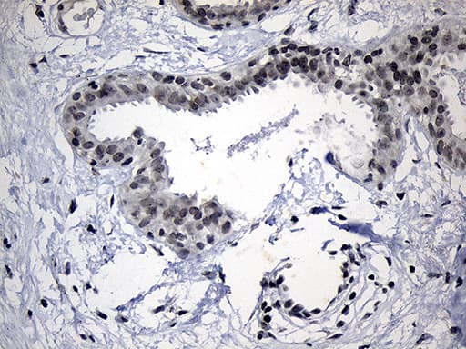 ELL / MEN Antibody (aa302-621, clone OTI3A8)