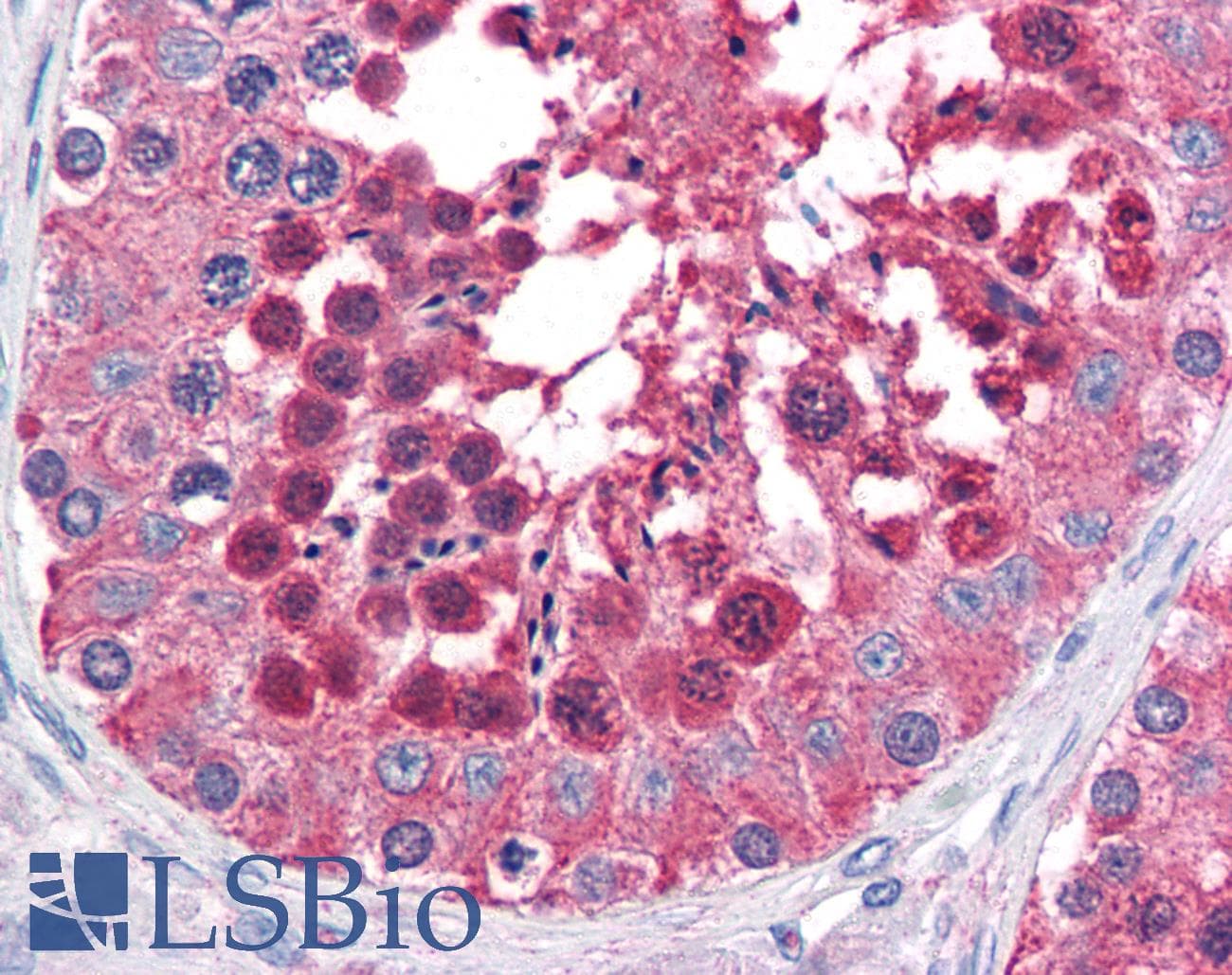 IHC-plus™ Polyclonal Goat anti-Human HSPA4L / APG-1 Antibody (aa825-839, IHC)