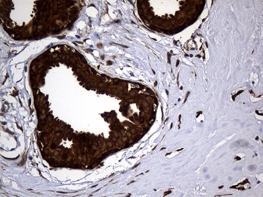 ALDH7A1 Antibody (clone OTI1A9, Carrier-free)