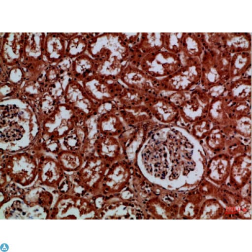 EYA1 Antibody
