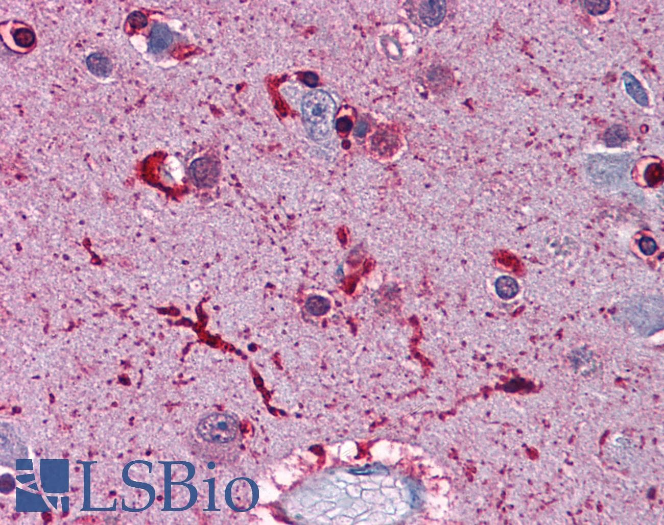 PathPlus™ FTL / Ferritin Light Chain Antibody (aa150-200)