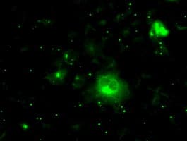 PRL / Prolactin Antibody (clone OTI9D12)