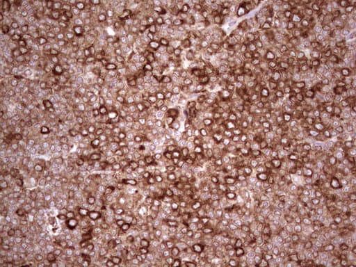 Monoclonal Mouse anti-Human YBX1 / YB1 Antibody (clone OTI11A7, IHC, WB)