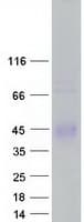 Human ZPBP2 Protein (Recombinant Myc-DDK (Flag))